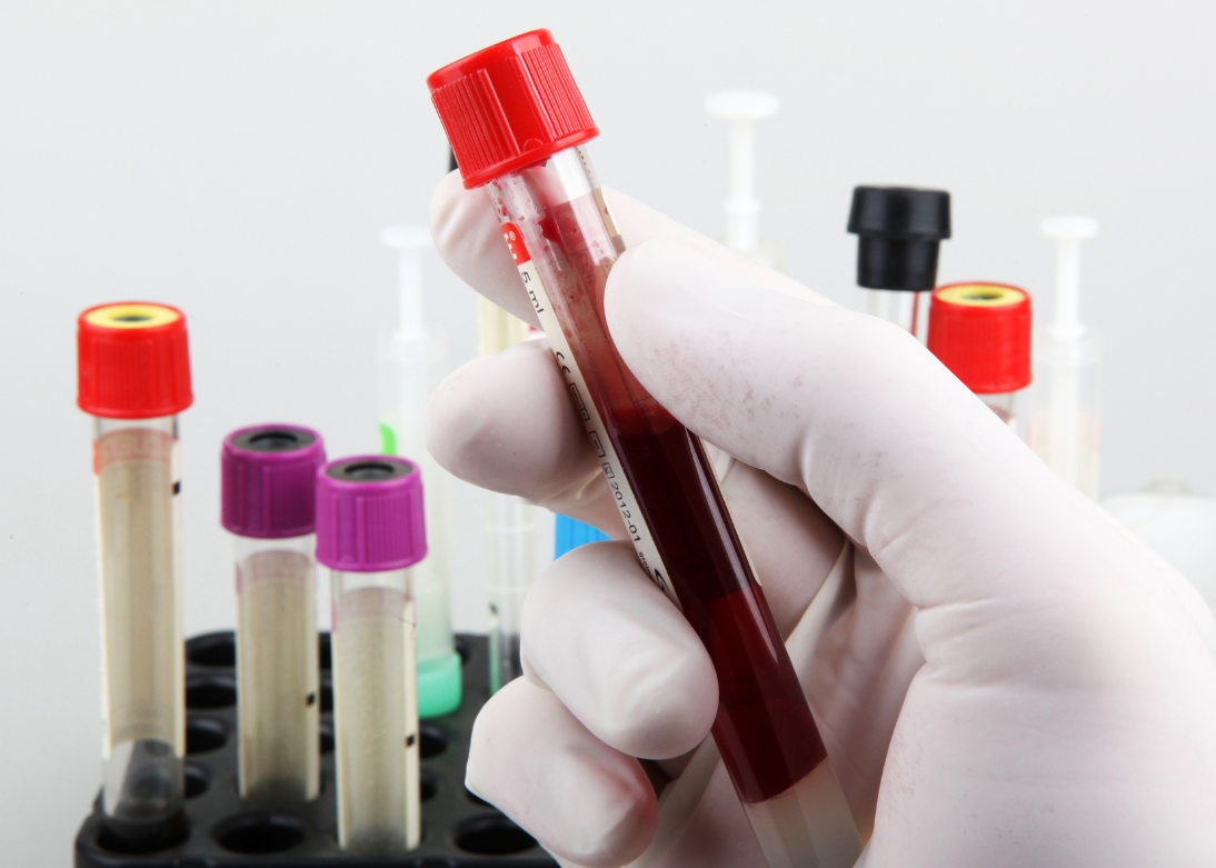 Blood Collection Centre